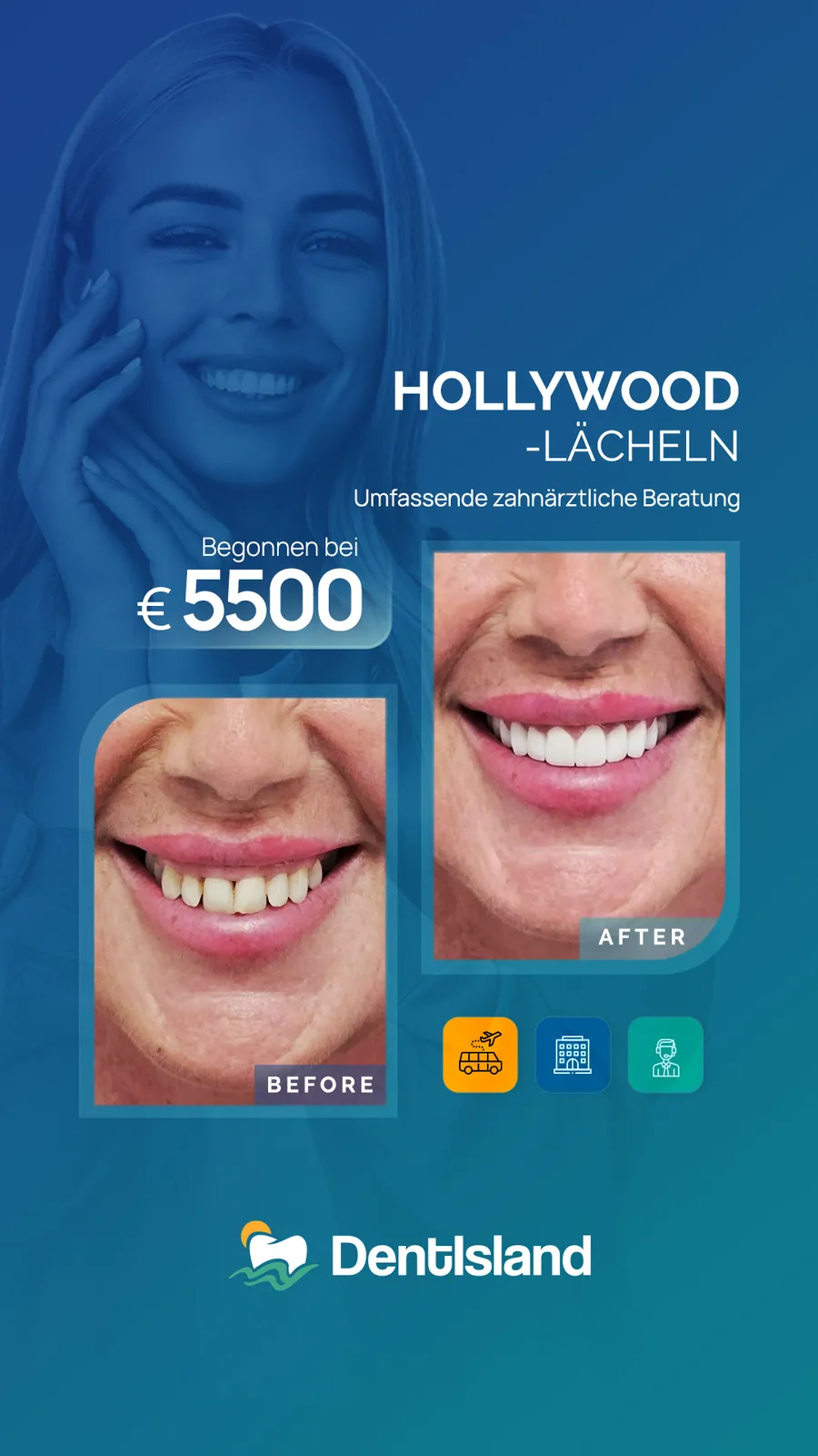 Hollywood smile